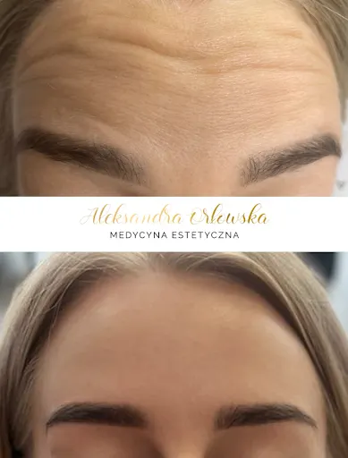 Medycyna Estetyczna Aleksandra Orłowska